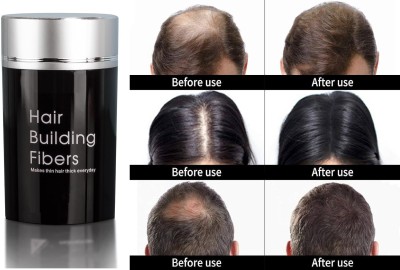 ADJD Hair Building Fibers For Hair Loss Concealer Regrowth Natural Black(25 g)