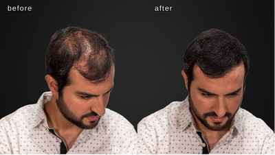 GFSU - GO FOR SOMETHING UNIQUE All Hair Building Fiber is absolutely natural Black 25gms(25 g)