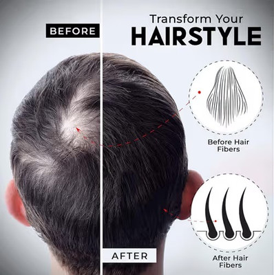 Arcanuy Hair Fibers For Hair Loss Concealer & Instant Styling Dark Black(22 g)