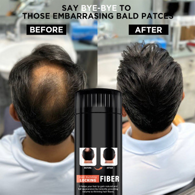 YAWI Black ReGrowth Hair Building Fiber Hair Hair Volumizer Fiber 2STAR Medium Hair Volumizer Powder(22 g)