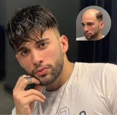 Growth Medium Hair Wig(Women)