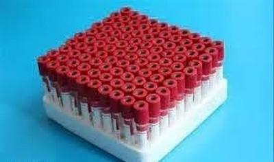 GALAXY SALES 4 Lab Vial(Pack of 100)