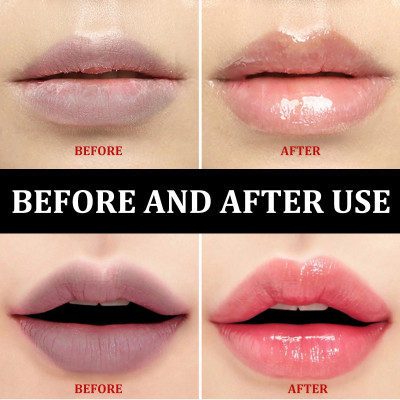 MYEONG Lip Scrub For Lip Lightening & Brightening Sugar Scrub Brighten Black Lips  Scrub(10 ml)