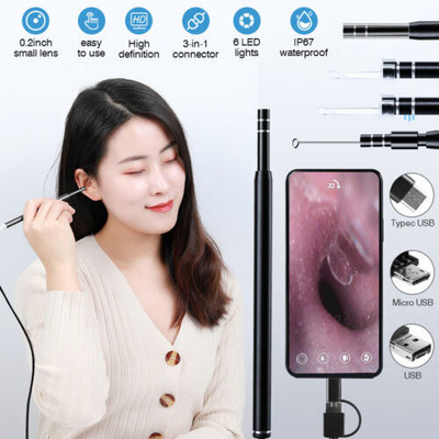 atdaraz Otoscope Ear Cleaning Camera,Earwax Removal Kit with Camera Wireless Microscope Slide Box