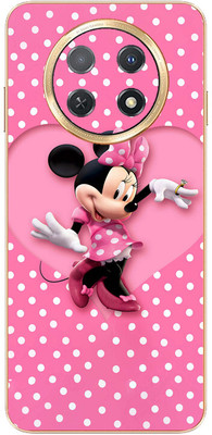 FCS Huawei Enjoy 60X Printed Back skin Mobile Skin(Mickey Mouse)