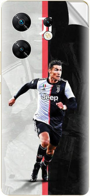 tiddler Infinix Zero 30 4G Mobile Skin(Black&White)