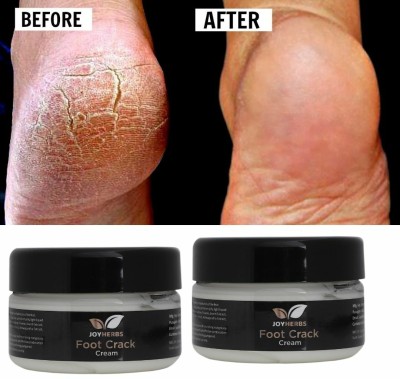 JOYHERBS Foot Crack Cream Crack Blaster Repair - Cracked Skin, Heel(Pack Of 2)(100 g)