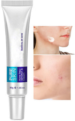 GABBU Acne & Blackheads | Suitable for All Skin Types | For Men & Women(30 g)