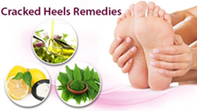 SUBIA CRACK CREAM HEELS REPAIR CREAM(50 g)