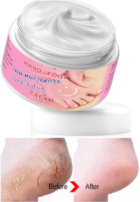 YAWI Hand & Foot Crack cream For Cracked ,Dry cream(50 g)