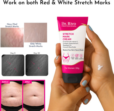 Dr rivo professional Stretch Mark Removal Cream for Women | Safe During & After Pregnancy(50 g)