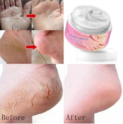 HUZURLU Feet Crack Heel Repair Cream Smooth Foot Crack Cracked Heel Repair(100 g)