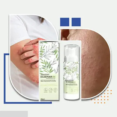 zexston Herbal Eczemaron Cream Pack Of 1.9(50 ml)