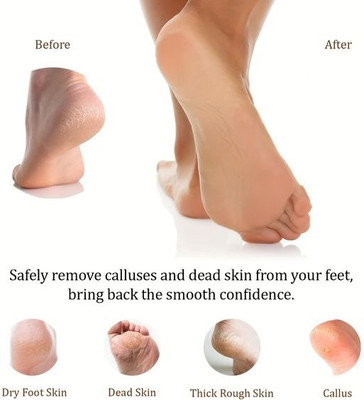 GABBU Use Heel Repair Cream for Feather Soft Feet(50 g)