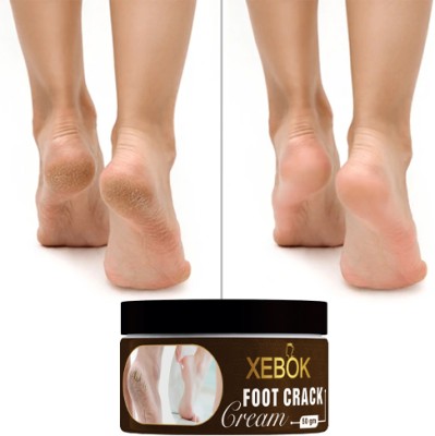 Xebok Cracked Skin,Heel, Finger Healing Balm and Crack Blaster Dry Skin and Body Cream(50 g)