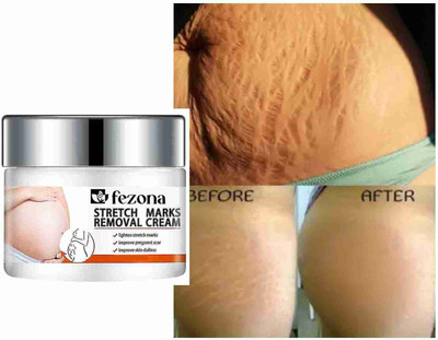 FEZONA Herbal Stretch Mark Removal Cream 100 gm - Paraben And Sulphate Free(100 ml)