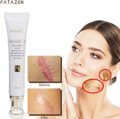 ARMM Products Scar Removal Cream for Acne Marks & Dark Spots | Face & Body Cream(30 g)
