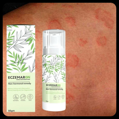 BUZIVENTURES Eczemaron Anti Fungal for Cracked & Dry Skin_MZ123(50 g)