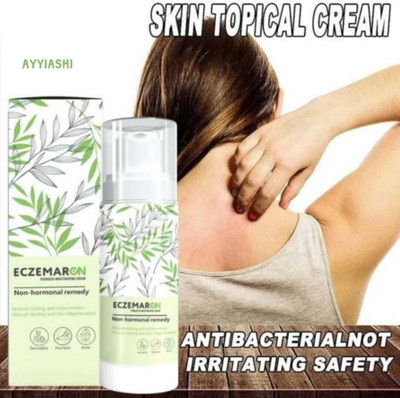 AYYIASHI Eczemaron Intensive Antifungal Cream For Redness And Irritation(100 ml)