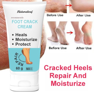 Naturalleaf feet Smooth Foot Crack Cracked Heel Repair Foot Cream(60 ml)