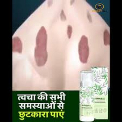 Kenkoderm Eczemaron Anti Fungal Cream Spray(50 g)