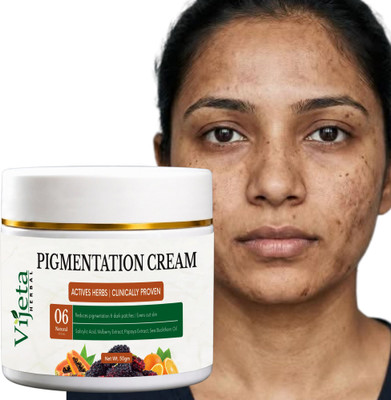 7 Days Vijeta Herbal Pigmentantion Cream _ 50 gm(50 g)
