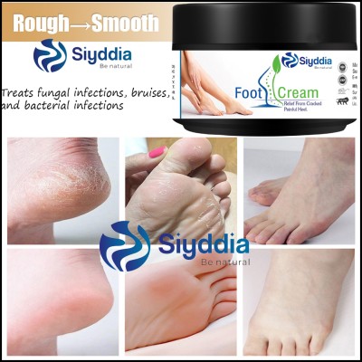 SIYDDIA Cracked Heel Repair Cream Smooth Foot Crack Cracked Heel Repair Foot Cream-50g(50 ml)
