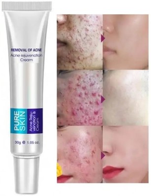 MYEONG pigmentation Cream Acne Scar Removal Cream(30 g)