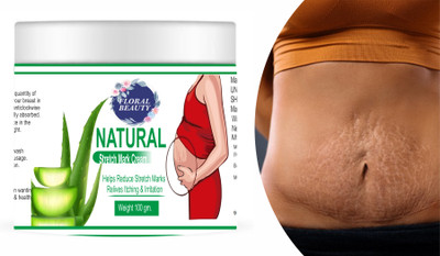 FLORAL BEAUTY Stretch Marks & Scars Cream and Itchy Skin Scar removal for pimple marks(99.5 ml)