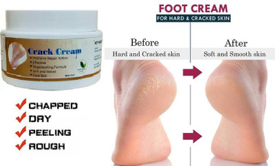 GABBU Crack Cream For Cracked ,Dry & Dehydrated Skin Enriched(50 g)