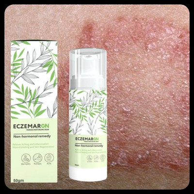 BUZIVENTURES Eczemaron Anti Fungal Cream for Fast Itch Relief_MZ13(50 g)