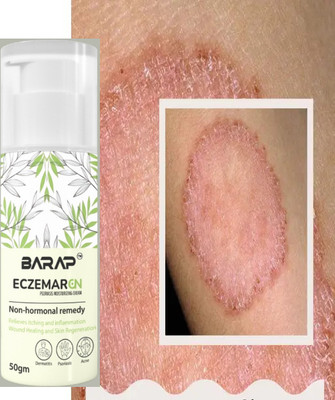 barap eczemaron anti fungal Clear Skin Fast with Ecz Anti-Fungal Cream Boost amar(50 ml)