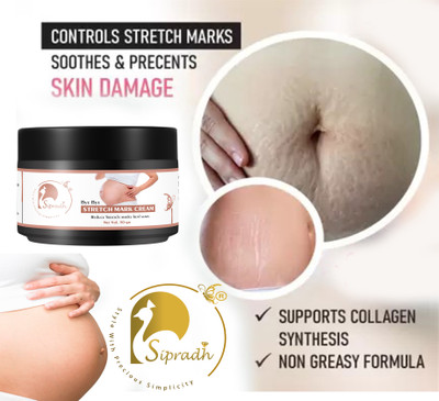 Sipradh Pregnancy and maternity Stretch marks Removal Cream(50 g)