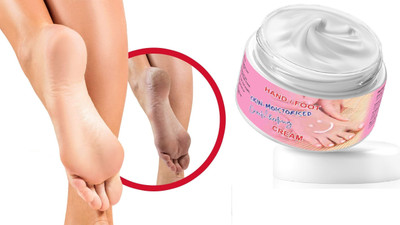 YAWI Cream For Rough, Dry and Cracked Heel And Hand, Feet And Hand Cream For Healing(50 g)
