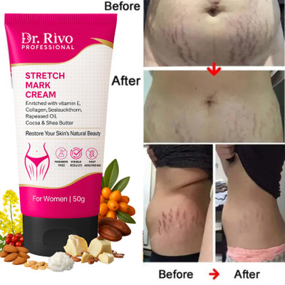 Dr rivo professional Stretch mark minimizer creams enhance skin elasticity Under Arm Body Fat Mark(50 g)