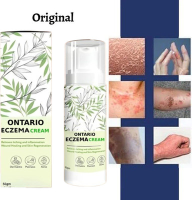 Ontario Herbal Eczemaron Cream Pack Of 1(50 g)