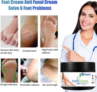 SIYDDIA healthy Feet Foot cream for Cracked heels&moisurise,smooth foot -50gm(50 ml)