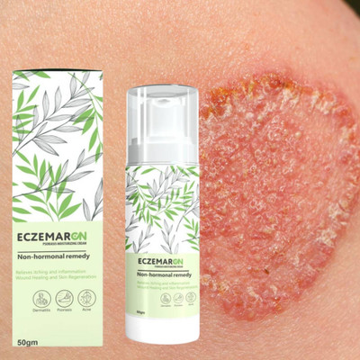 ACTIWOW Eczemaron Anti Fungal for Healing Skin & Fungus Prevention A01(50 g)