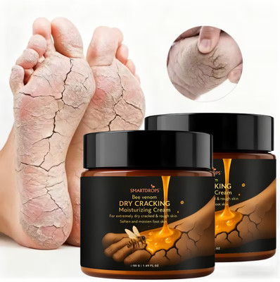 smartdrops Foot Crack Cream - Anti-Fungal Infection & Skin Softening Unisex Use(100 g)