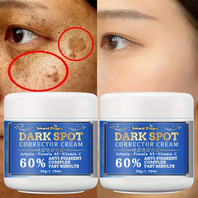 smartdrops Dark Spot Corrector Cream For Remove Pimple Marks, Acne Scar Blemishes(100 g)