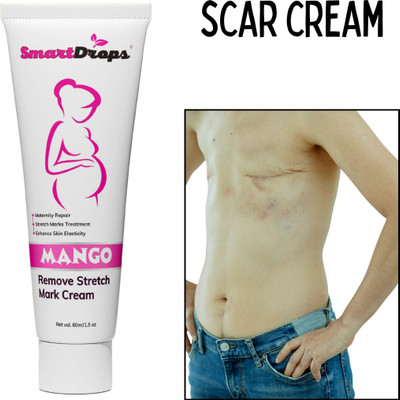smartdrops Stretch Mark Cream For Scars, Ageing, Firming Body Cream for All Skin Type(60 ml)