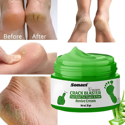 Sonavi Foot Balm for Repairing Cracks & Softening Skin with Cooling & Refreshing Effect(50 g)