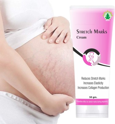 wvhc stretch marks cream for women after pregnancy stretch marks cream and oil(50 g)