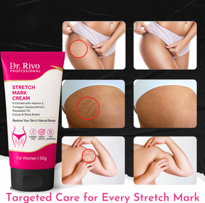 Dr rivo professional Stretch Marks Cream for Reducing Stretch Marks & Scars(50 g)