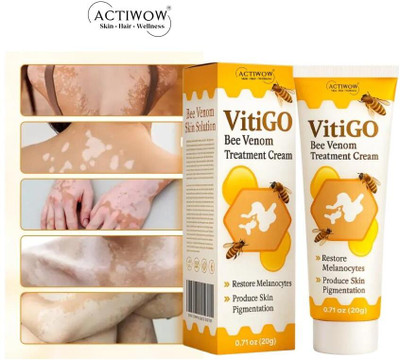 ACTIWOW Vitigo Bee Venom Cream for Lightweight Daily Hydration cream Moisturizer(100 g)