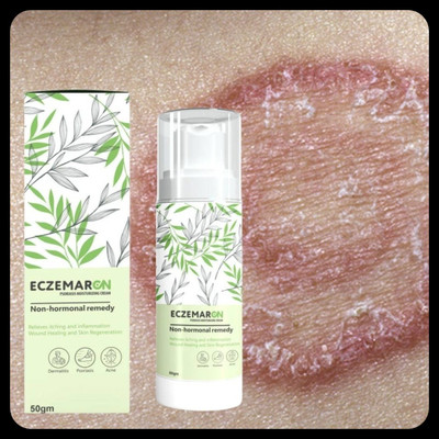 BUZIVENTURES Eczemaron Anti Fungal for Treating Rash & Skin Inflammation_MZ50(50 g)