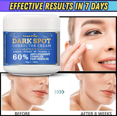 smartdrops Dark Spot Removal ||Reduce Dark Spot ||Pigmentation & Radiance Glow Cream(50 g)
