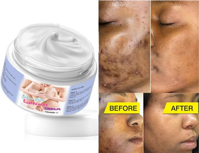 luzimaisa Best Private Part Whitening Cream Intimate Underarms Bikini Area Remove Cream Intimate Cream(50 g, Pack of 1)