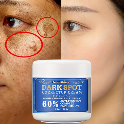 smartdrops Dark Spot Corrector Cream For Remove Pimple Marks, Acne Scar Blemishes(50 g)