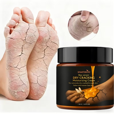 smartdrops Foot Crack Cream - Anti-Fungal Infection & Skin Softening Unisex Use(50 g)